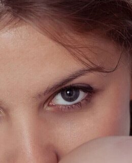 Fiora — фото 12