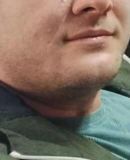 Арсениц — фото 3